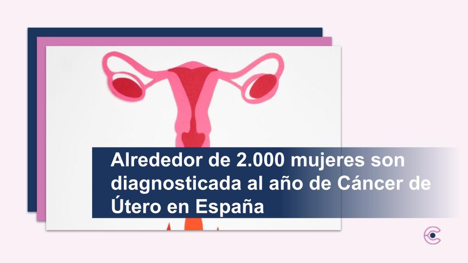 Alrededor de 2.000 mujeres son diagnosticada al año de Cáncer de Útero en España